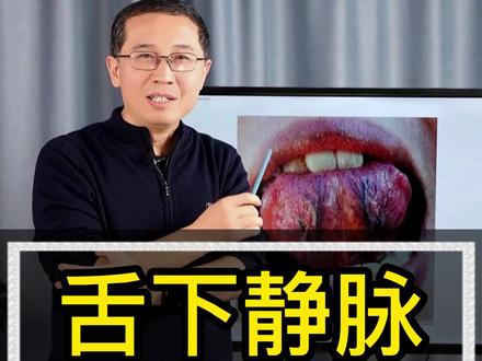 【舌苔】舌下静脉又粗又黑
舌下的两个静脉都有两个穴位,一个是金津,另一个是玉液,因此这两个穴位非常重要。二穴主要有清热解毒,生津止渴之功,颜色发黑可能与人体内热有关
#李晓阳医生 #男科 #关爱男性