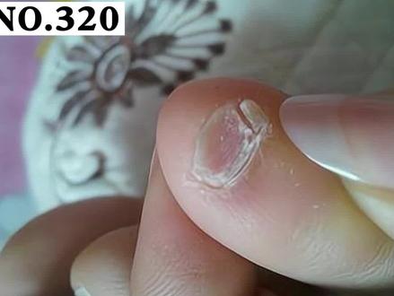 #脚趾甲 分成两瓣才是纯种汉族人?你家里人都是吗#皮肤 #健康 #科普