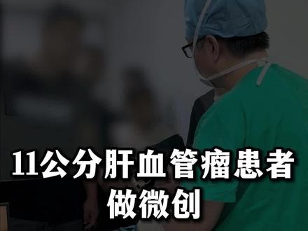 35岁女性患有11公分肝血管瘤,症状是饭后饱胀不适,我们选择用腹腔镜给患者做肝血管瘤剥除术#肝血管瘤 #微创手术 #腹腔镜