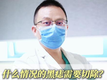 什么情况的黑痣需要切除?可以怎么改善? #黑痣 #色素痣 #色素痣祛除