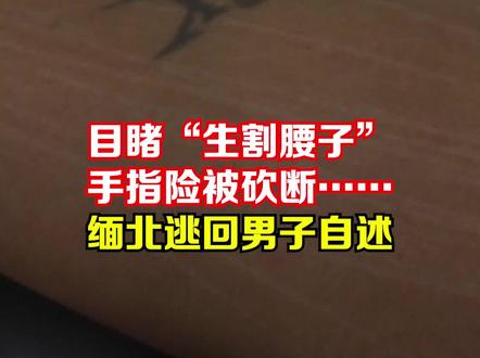 目睹“生割腰子”、手指险被砍断……缅北逃回男子自述