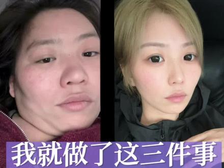 大基数减肥|10个月瘦80斤,不节食不反弹,就靠这3件事!#大基数减肥#减肥经验分享#饿瘦#减肥不反弹#减肥干货