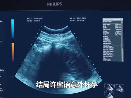 大结局许蜜语意外怀孕,4个霸总抢着当爹,聂予诚跪求复婚 #我也来给蜜语记二创了 #蜜语记 #朱珠 #钟汉良 #李梦