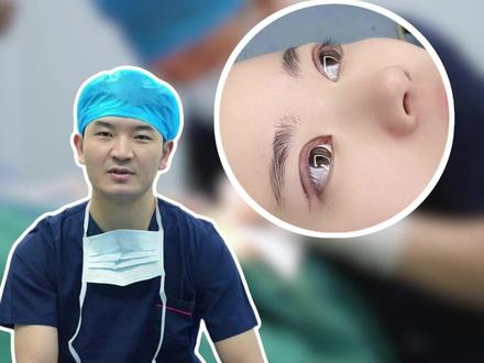双眼皮术后保姆级护理攻略 #变美那些事 #双眼皮 #医疗健康训练创作营 #抖出健康知识宝藏