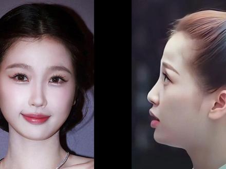 正脸好看,侧脸不好看的人记住这3点 #变美 #侧脸 #杉姗美学