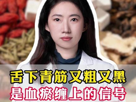 舌下青筋又粗又黑,是血瘀缠上的信号 #中医 #气滞血瘀 #健康科普 #抖出健康知识宝藏