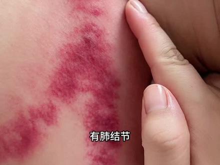 云门中府位置#健康养生