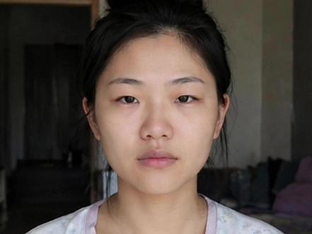 chatgpt image2,彻底模糊了医美生图真实的边界 #image2 #chatgpt #gemini #医美 #ai图片