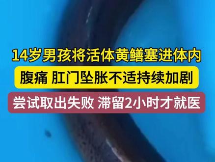 14岁男孩将黄鳝塞体内2小时才就医(海报新闻)