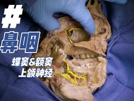 头部除了大脑,还有哪些有趣的存在?#大体老师令人敬佩 #大体老师