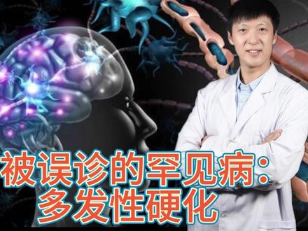 易被误诊的罕见病:多发性硬化 #多发性硬化 #脑 #健康 #误区 #卒中防控立即行动 #血管 #科普一下
