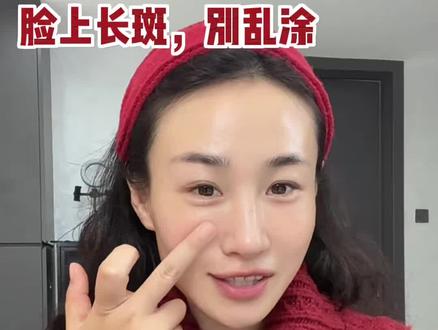 脸上长斑,黄气重,真的不是脸上的问题, 肚子凉爱喝冰气血差的人脸上最容易长斑#脸上长斑 #黄褐斑 #手脚冰凉##抖音创作者中心