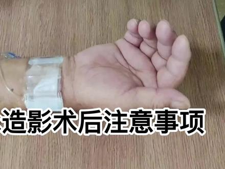 冠脉造影术后注意事项#冠脉造影 #医学科普 #泰心内三科