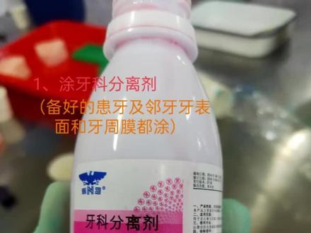 #印模法
1)对于牙体形态基本完整的牙可在预备前用藻酸盐取印模,然后修整印模:去除印模边缘的倒凹区,在上颌中切牙间作V形沟以利于印模复位。
2)根据预备要求完成对该牙的牙体预备。
3)按照暂时冠材料说明书要求,将基质和催化剂按比例混合调拌放入注射器中,注入预备体对应的印模内,注射时应随时排空空气,避免气泡混人;多余的材料置于操作者手背,以指示材料硬固程度。
4)将印模戴人口内,确认完全就位 ,待暂时冠材料基本凝固后(材料在该阶段有一定的弹性)取出印模,再取出暂时冠,检查暂时冠的完整性,如不合格则重新制作。
5)待暂时冠材料完全凝固硬化后修改暂时冠边缘至合适,戴入预备体,若就位困难,用咬合纸逐步试出邻面及冠内面阻碍点,直至完全就位。边缘要求同铸造全冠的边缘要求一致:密合、无悬突、无缺损。
6)调整牙冠的外形、咬合:利用咬合纸检查出暂时冠面的咬合高点并磨除;参考邻牙以及对侧同名牙的外形特点对暂时冠的唇面突度、唇面外形进行调改。
7)磨光、抛光。(2)预成套冠法
1)选择与患牙大小相近的预成树脂套冠,修整牙冠边缘至合适。2)用自凝单体浸润预成套冠组织面。
3)调和自凝树脂:取适量自凝粉,逐滴加入自凝单体直至自凝粉被浸透,调匀。
4)用自凝树脂重衬牙冠:自凝树脂进入拉丝后期后,将其压入预成冠内,再将预成冠在预备体上就位,沿边缘清理多余的树脂材料。
5)在自凝树脂完全硬固前(橡皮期)取下,然后再将其戴回预备体,以免未完全固化的树脂变形。
6)调整牙冠的外形、咬合:在自凝树脂完全硬固后进行。
7)磨光、抛光。#临时冠制作