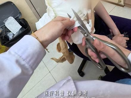 微创狐臭祛味术后第3天,来换药啦 #狐臭 #腋臭 #狐臭手术 #腋臭医生王峰