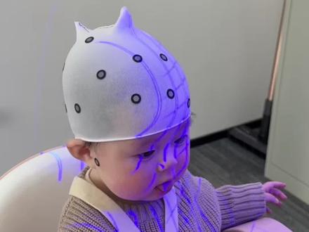 宝宝头型矫正头盔换头盔扫描过程,头盔的原理,以及戴头盔意外发现的好处