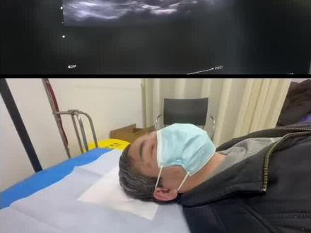 #颈部血管 #颈部血管彩超 #颈部血管检查技巧 #第七届血管超声试听课