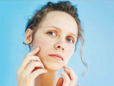 常喝碳酸饮料会对皮肤产生影响吗?#每日科普#科学护肤不走弯路 #皮肤管理 #问题性皮肤管理