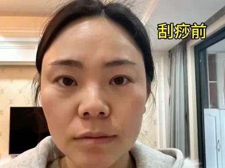 新手刮痧跟练,30➕素颜远超同龄人#刮痧 #面部刮痧 #脸部提升