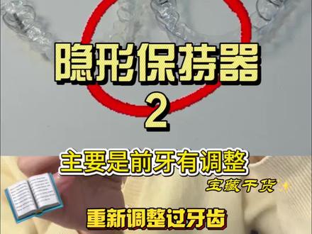隐形保持器收到了 #牙套#整牙#牙套日记#整牙经历#保持器