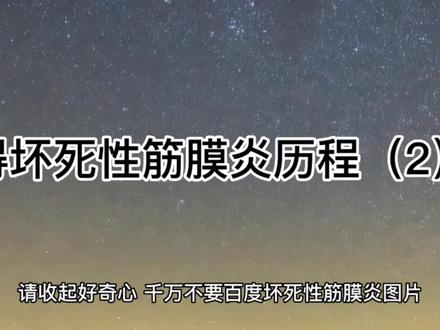 #只有经历过的人才会懂 得坏死性筋膜炎历程(2))