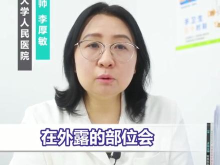 手上长了这种粗糙的硬疙瘩,这是寻常疣,可以这样处理它#涨知识 #科普