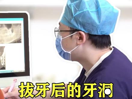 很多人担心拔万智齿留下的牙洞,食物塞进去长在里面怎么办?#口腔科刘博闻 #智齿疼 @抖音小助手