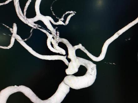 中药怎么吃效果最好的 bfe02a7bee70f6b54e45886e353d07c9~tplv-dy-resize-origshort-autoq-75:330.jpeg?x-expires=1994832000&x-signature=vOWUFD6ayjsHFINGxy64iAGjxB4%3D&from=3213915784&s=PackSourceEnum_AWEME_DETAIL&se=false&sc=cover&biz_tag=pcweb_cover&l=021679472612724fdbddc03001308428e42112f40000015fbd4cd