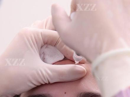 【实录】额结节塑造,改善额头后倾 #额结节 #美商 #面部折叠度 #额头后倾 #注射