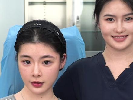 肉肉脸变上镜脸~#杭州姚伟丽#娇媛天使#变美 #逆袭