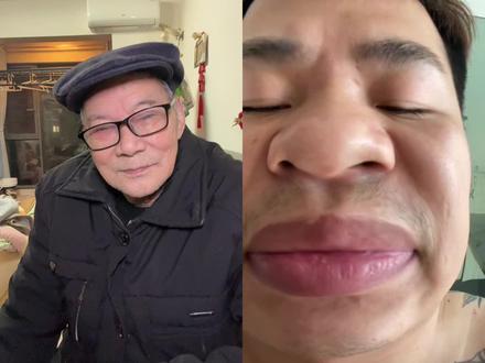 和 @皮肉哥(阿命睁选) 一起 #合拍 @皮肉 #福州话