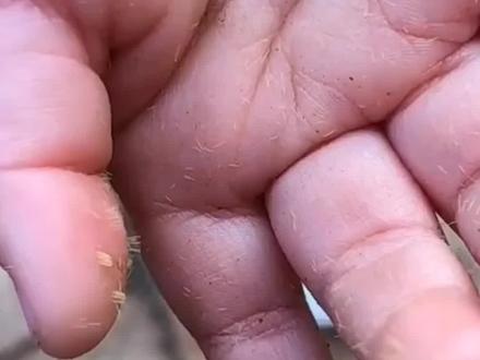 小女孩手抓仙人掌满手刺,四个大人轮流清理一小时,挺坚强的一声没哭#孩子 #抖音小助手 #dou上热门