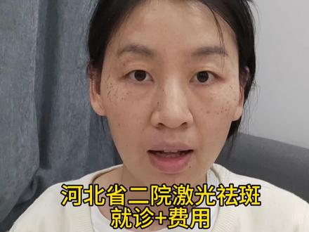 从小长的遗传性雀斑,花4000块去三甲医院激光祛斑#无美颜无滤镜 #祛斑 #遗传性雀斑