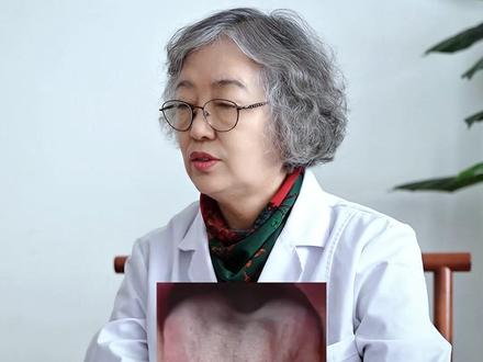 这可不是肝郁气滞,而是脾虚气滞,疏肝就错了 #中医 #舌诊