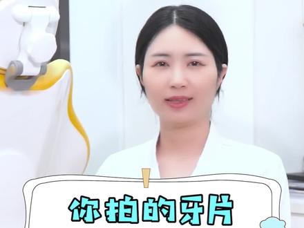 为啥拍牙片不给你片子,看完你就知道啦#健康科普 #健康