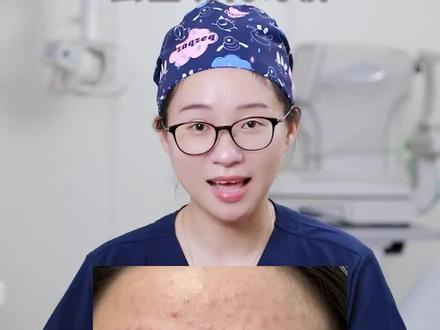 为什么注射水光会出现肉芽肿#变美 #医学科普 #变美攻略