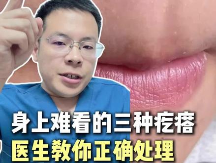 身上这3种难看的疙瘩,别瞎挤!医生一条视频教你正确处理。 #火疖子 #痘印 #毛囊炎 #痘印怎么消除 #抖出健康知识宝藏