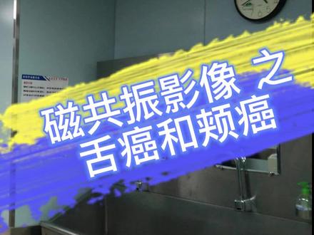 医生笔记01:磁共振影像 之 口腔癌 #槟榔 #癌前病变 #口腔黏膜纤维化 #口腔黏膜下纤维化 #湖南 #中南大学湘雅二医院 #口腔粘膜 #口腔科普 #口腔癌