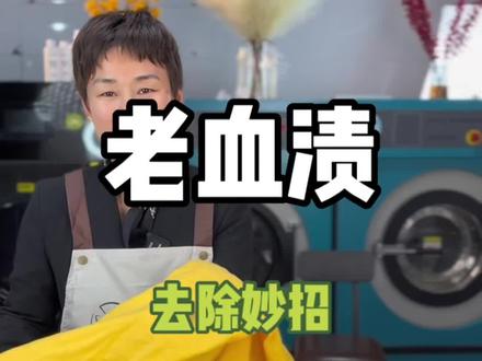 衣物床单上的老血迹怎么洗干净彻底不掉色?#清洁妙招 #去血渍