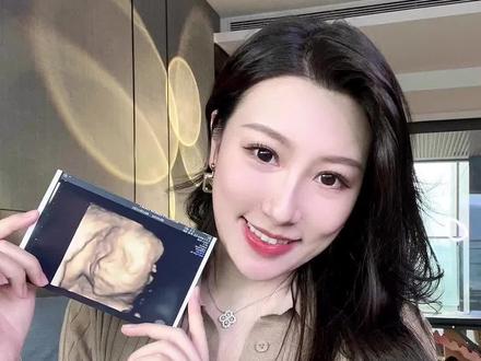 分享下我奇幻的一周备孕中奖经历🤣
#怀孕日记 #备孕那些事 #怀孕那些事 #怀孕前后 #嫁给爱情 #家有喜事 #fyp #愿所有人都能嫁给爱情