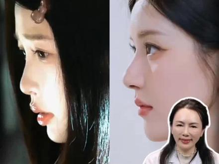 皮相美VS骨相美
来看看你是哪种美#皮相美和骨相美的区别 #周口赵书英#周口#周口双眼皮