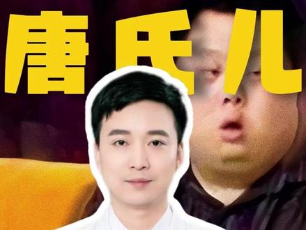 什么是唐氏综合症?要重视预防和干预#唐氏综合症#唐氏 #唐氏筛查 #抖出健康知识宝藏#医疗健康创作训练营