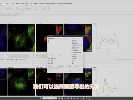 快速搞定免疫荧光图片局部放大和排版 channel scope studio#免疫荧光 #免疫荧光共定位 #科研 #科研绘图