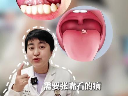 嘴里长菜花归谁管?#妇科 #医学科普 #全民健康素养提升
