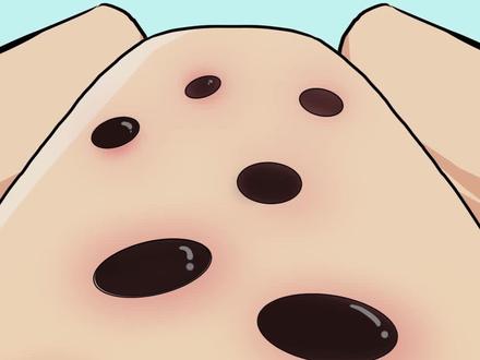 管住!千万别再用手挤黑头#黑头 #壬二酸