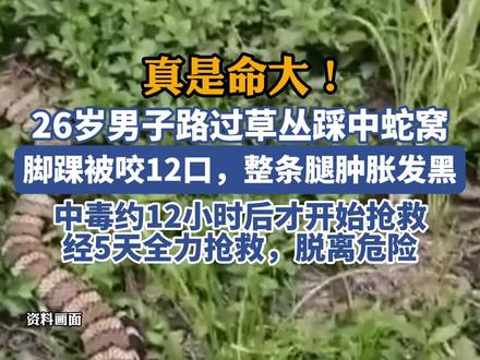26岁男子路过草丛踩中蛇窝,脚踝被咬12口,整条腿肿胀发黑
