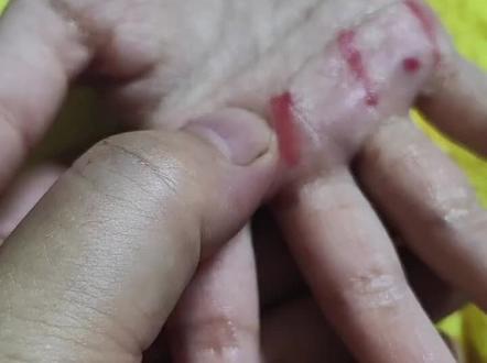 冬季来了,咳嗽的可以试试!