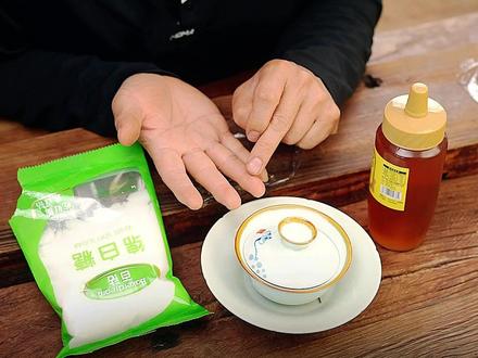 用盖碗被烫伤该如何处理? 今天老王分享一个处理烫伤的小方法,缓解疼痛很有用#烫伤 #烫伤处理 #召唤茶友 #盖碗烫手怎么办 #召唤茶友