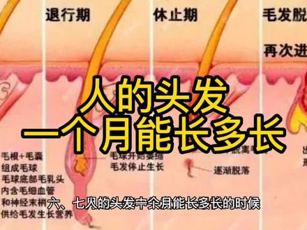 人的头发一个月能长多长? #头发护理 #科普知识 #涨知识 #头发 #掉头发 #头发稀疏