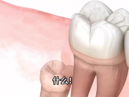 什么!长智齿说明我没进化完全?#冷知识 #长智齿 #有趣的知识又增长了